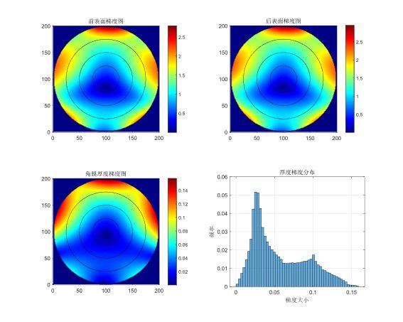 Corneal Topography